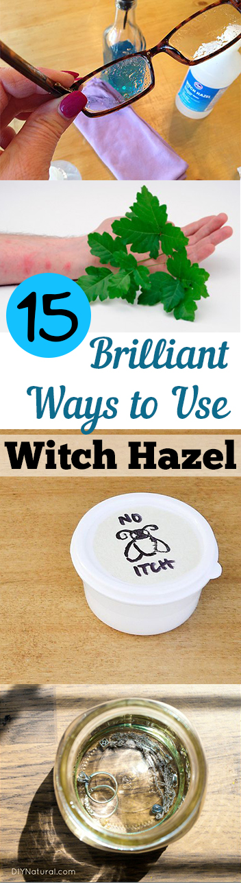 15 Brilliant Ways to Use Witch Hazel